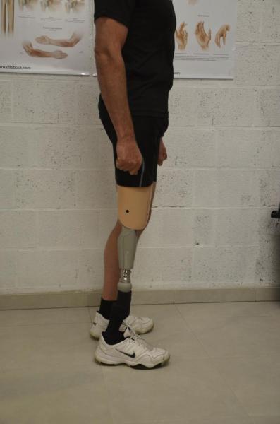 prothèse cuisse avec cache genou