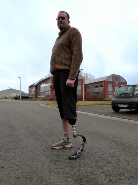 prothèse tibiale avec lame carbone