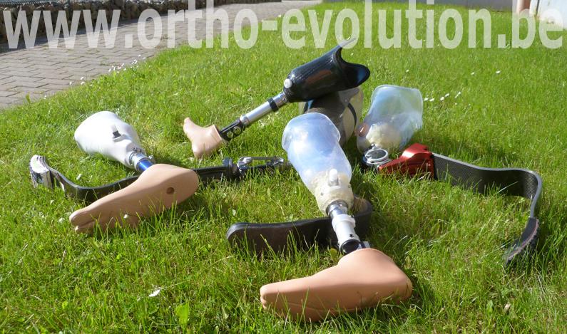 réalisations prothèses