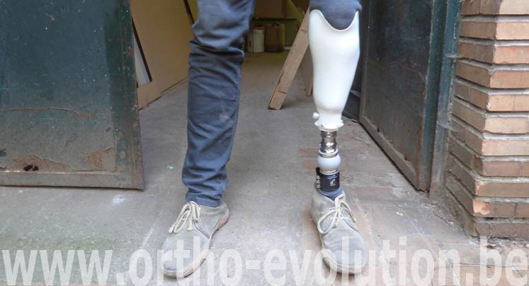 tibiale finition résine 2