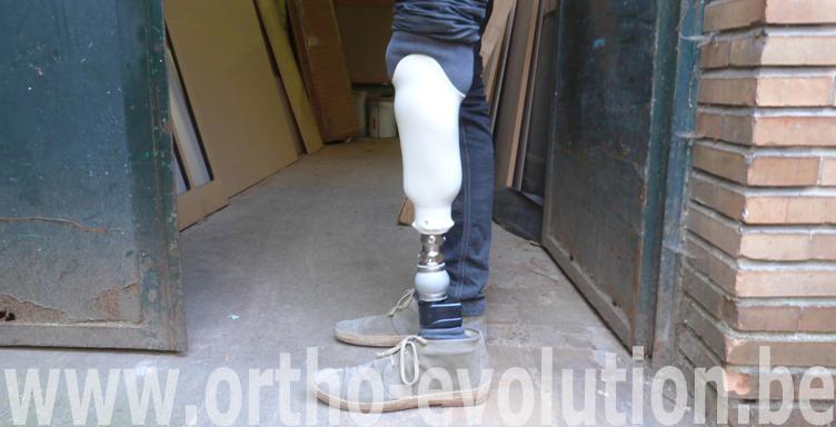 tibiale finition résine 3